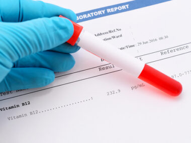 permanent hypoparathyroidism