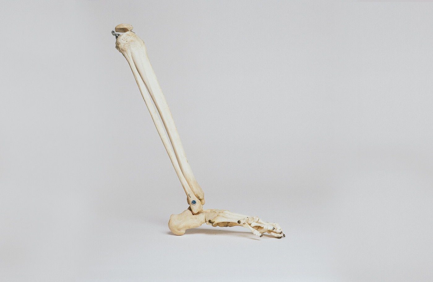 bone micrustructure