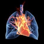 cardiovascular disease/hypoparathyroidismnews.com/disorders affecting heart blood vessels