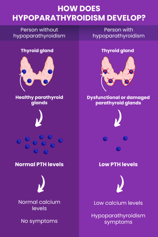 How hypoparathyroidism develops